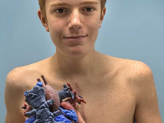 Teenage boy holds up a 3D printed mockup of his heart