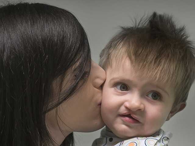 Mother kisses her son, who has a cleft palate, on the cheek while in the pediatric plastic surgery clinic